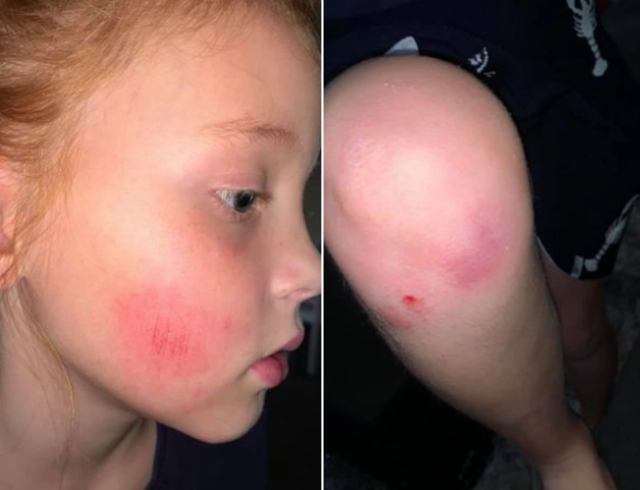 Meisje aangereden, getuigen gezocht!