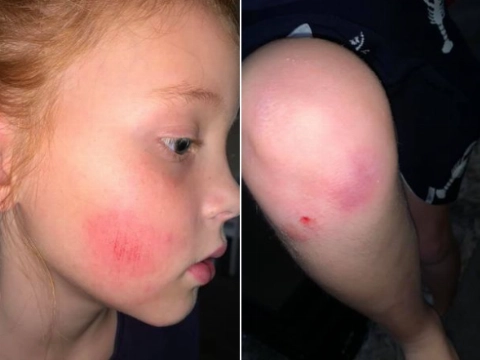 Meisje aangereden, getuigen gezocht!