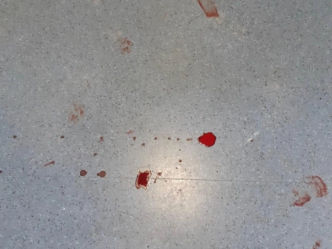 Bloedspoor leidt politie naar gewond persoon