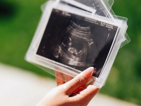 Zeer omstreden: ziekenhuizen gaan late abortussen uitvoeren
